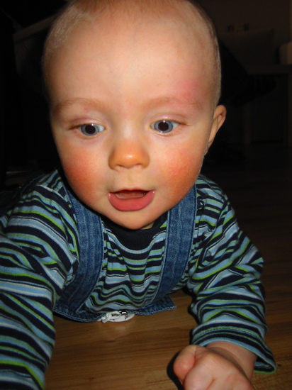 Rau&eth;ur &aacute; augabr&uacute;ninni
